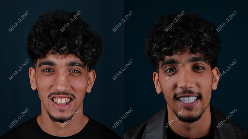 final result